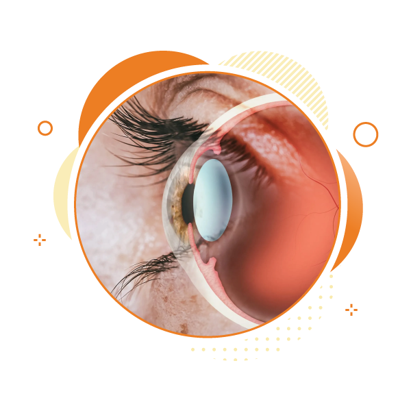 retina-eye-surgery-in-maharashtra