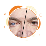 affordable cataract surgery in ghatkopar