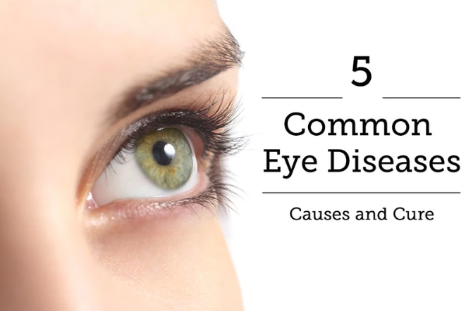 5 Common Eye Problems and How to aviod Them