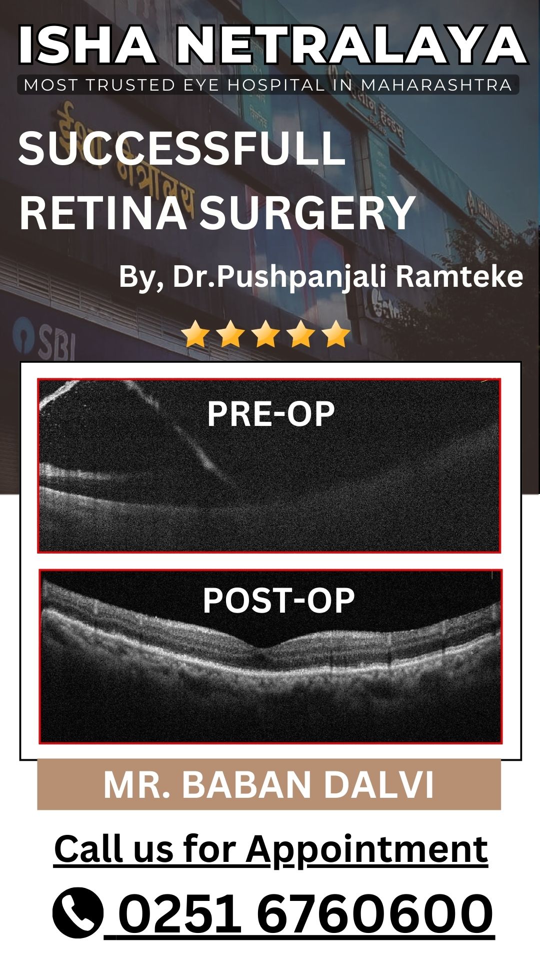 Retina treatment in kalyan