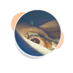 Corneal Transplantation