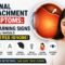 Retina detachment symptoms